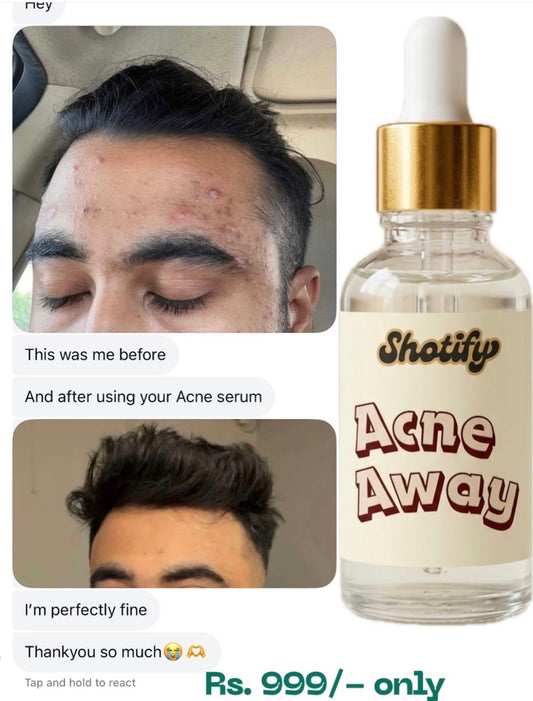 Acne Away Serum by Shotify