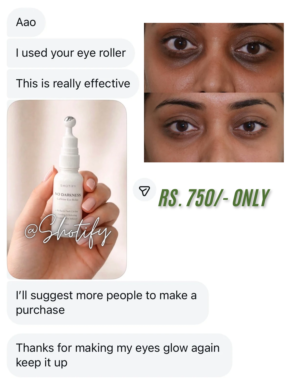 Under Eye Roller | Dark Circle Remover